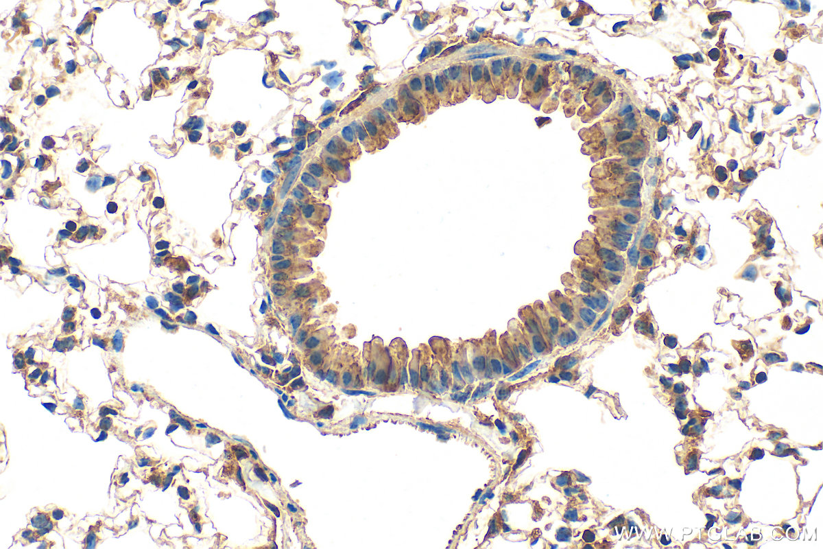 IHC staining of mouse lung using 20479-1-AP