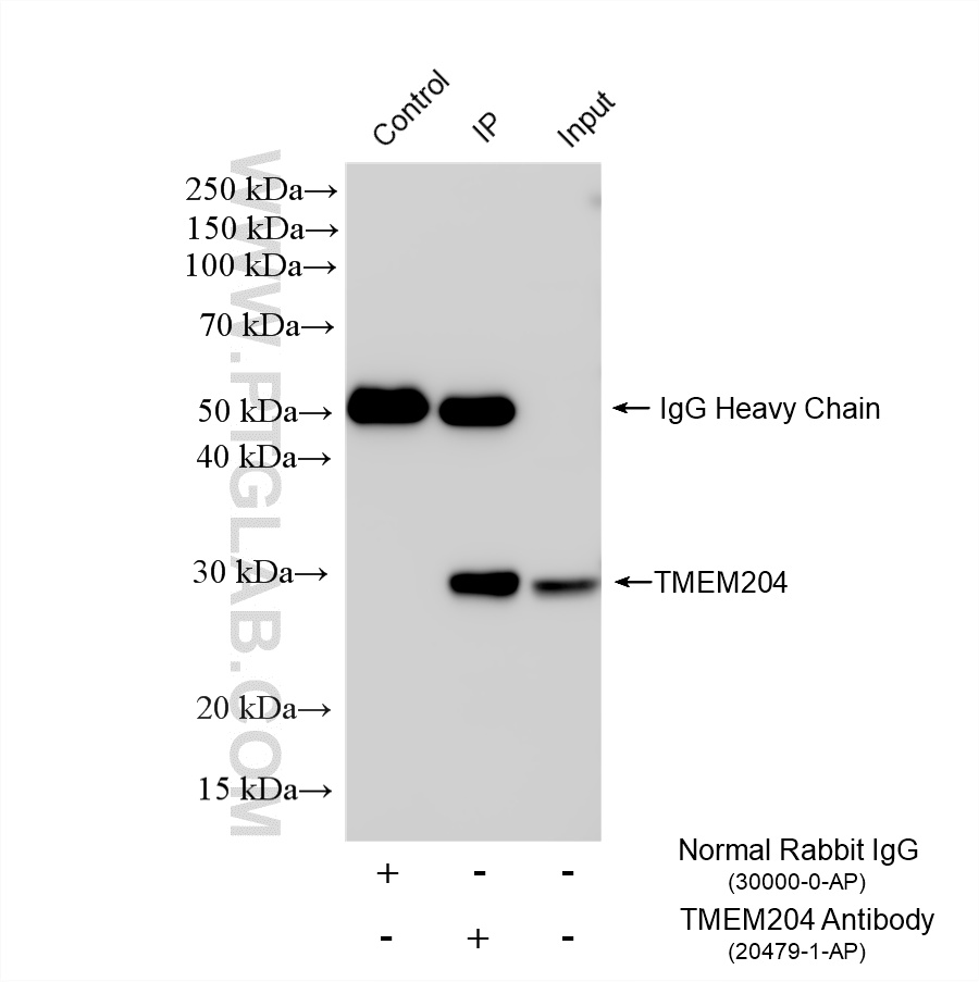 IP experiment of mouse kidney using 20479-1-AP