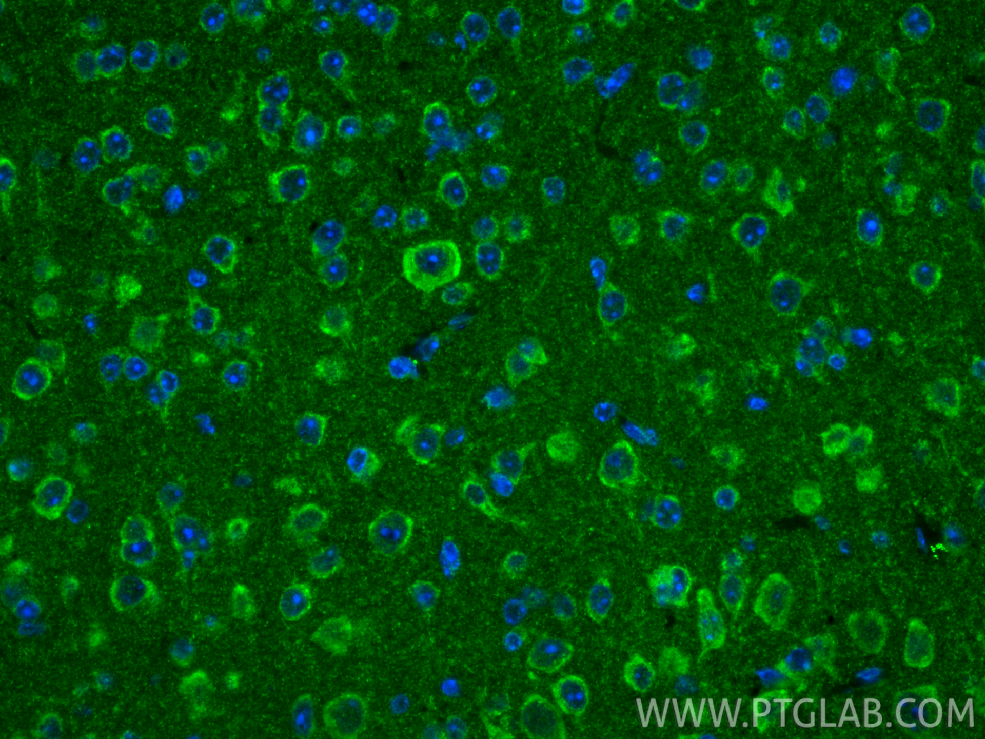 IF Staining of mouse brain using 32273-1-AP (same clone as 32273-1-PBS) IF Staining of mouse brain using 32273-1-AP (same clone as 32273-1-PBS)