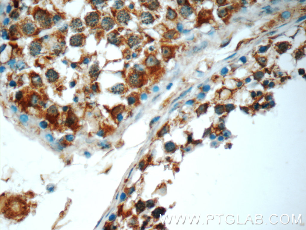 IHC staining of human testis using 24927-1-AP