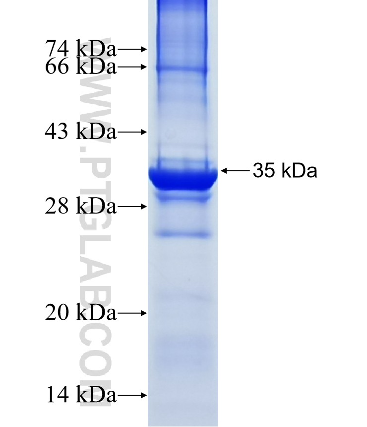 TMEM217 fusion protein Ag15587 SDS-PAGE TMEM217 fusion protein Ag15587 SDS-PAGE