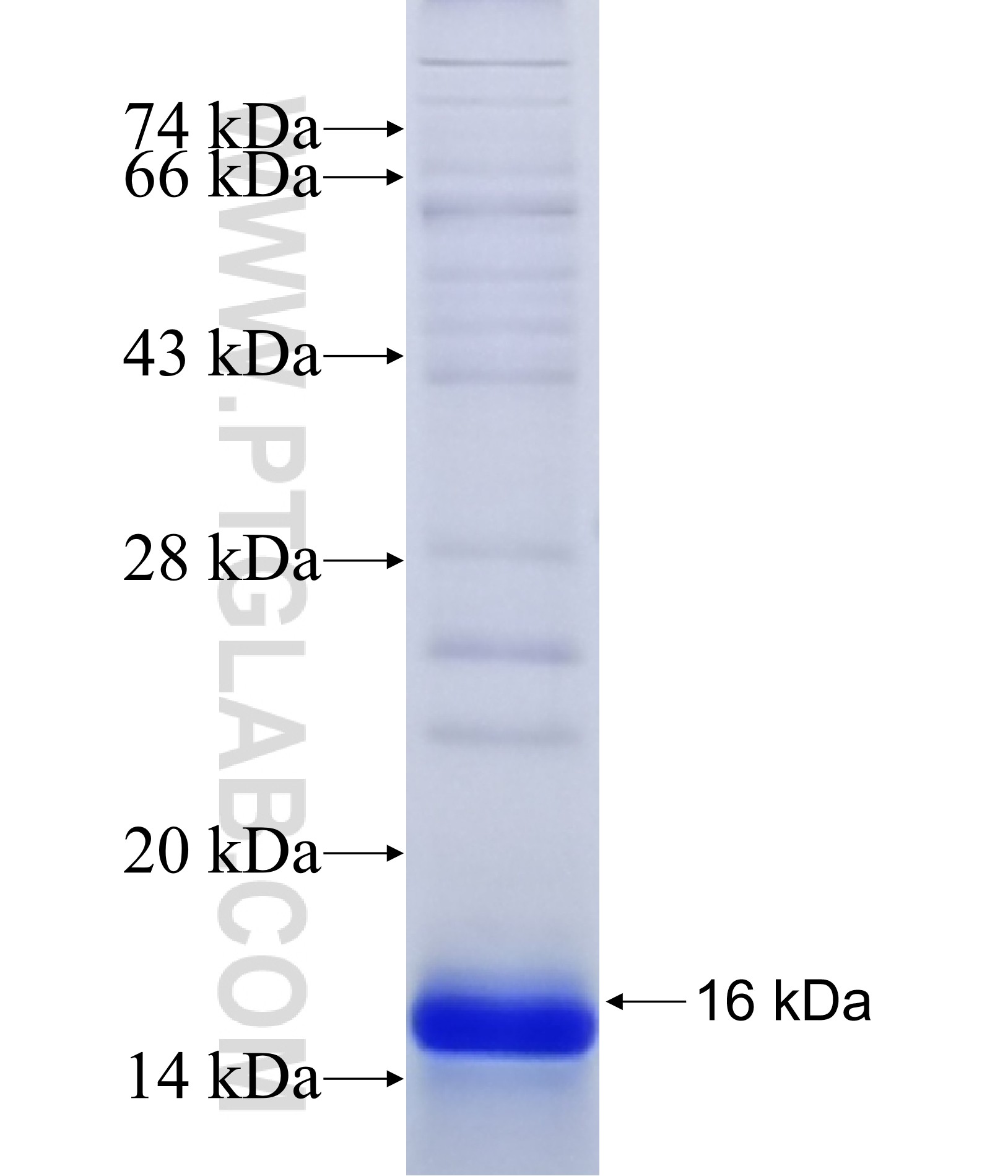 TMEM217 fusion protein Ag15760 SDS-PAGE TMEM217 fusion protein Ag15760 SDS-PAGE