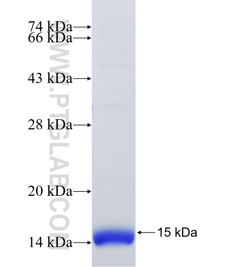 TMEM218 fusion protein Ag40896 SDS-PAGE TMEM218 fusion protein Ag40896 SDS-PAGE