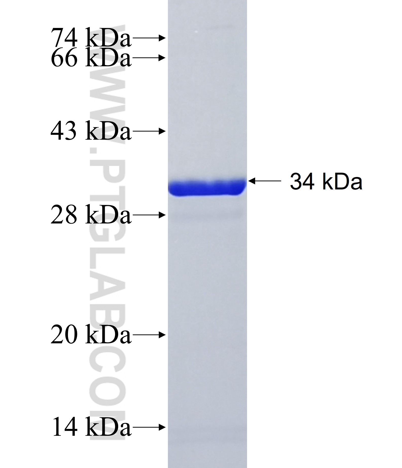 TMEM218 fusion protein Ag41011 SDS-PAGE TMEM218 fusion protein Ag41011 SDS-PAGE