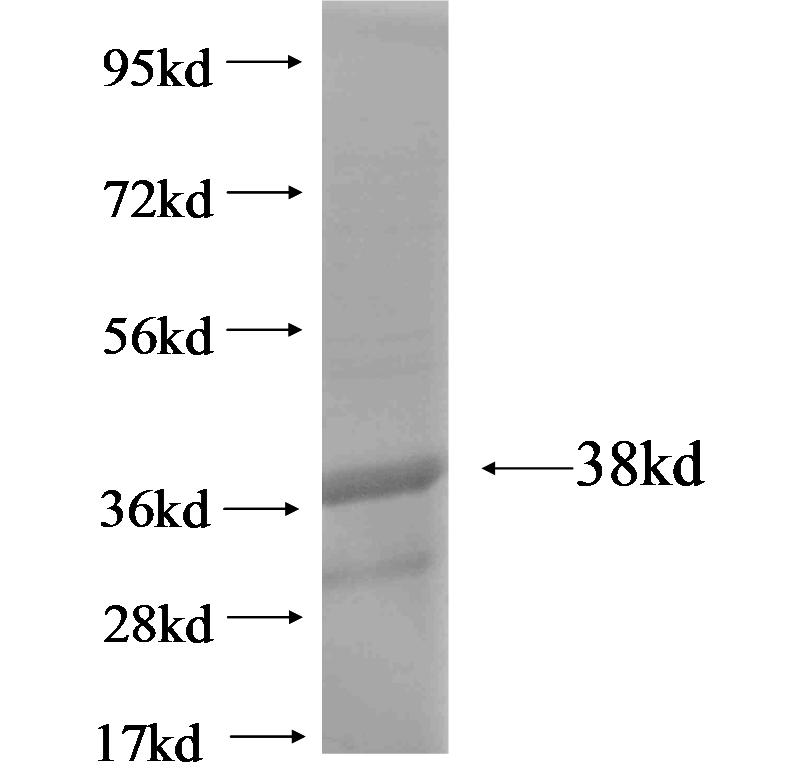 TMEM218 fusion protein Ag19225 SDS-PAGE TMEM218 fusion protein Ag19225 SDS-PAGE