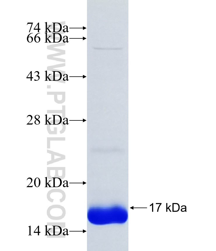 TMEM253 fusion protein Ag38444 SDS-PAGE TMEM253 fusion protein Ag38444 SDS-PAGE