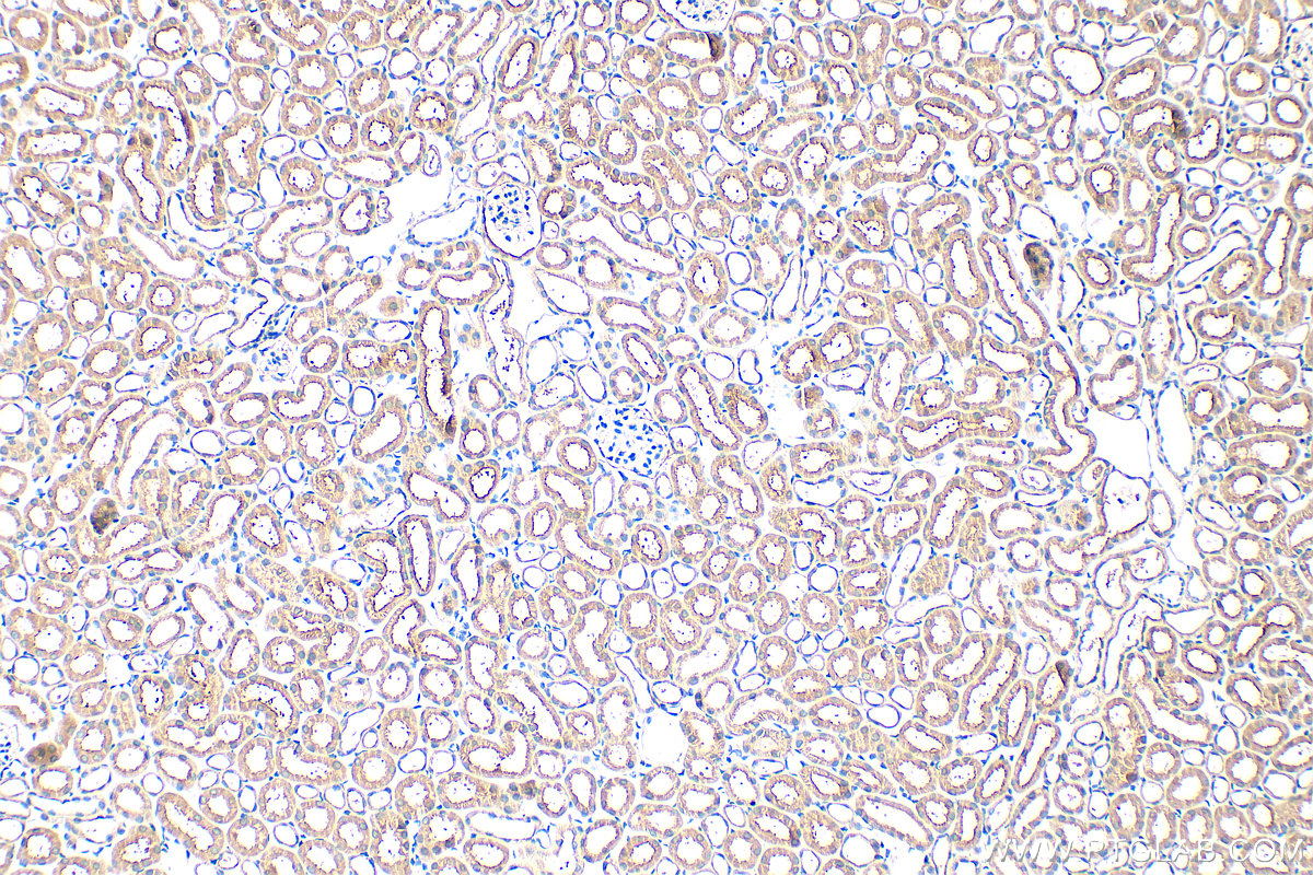 IHC staining of mouse kidney using 31525-1-AP