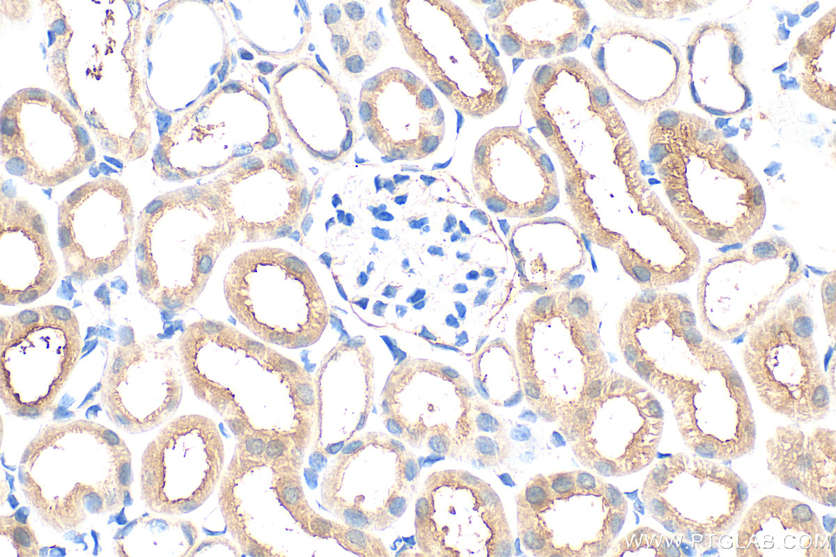 IHC staining of mouse kidney using 31525-1-AP