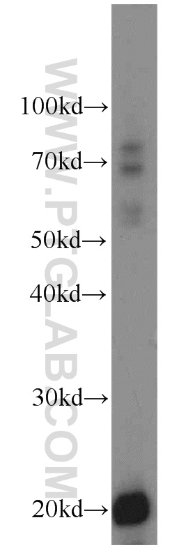 WB analysis of mouse pancreas using 14571-1-AP