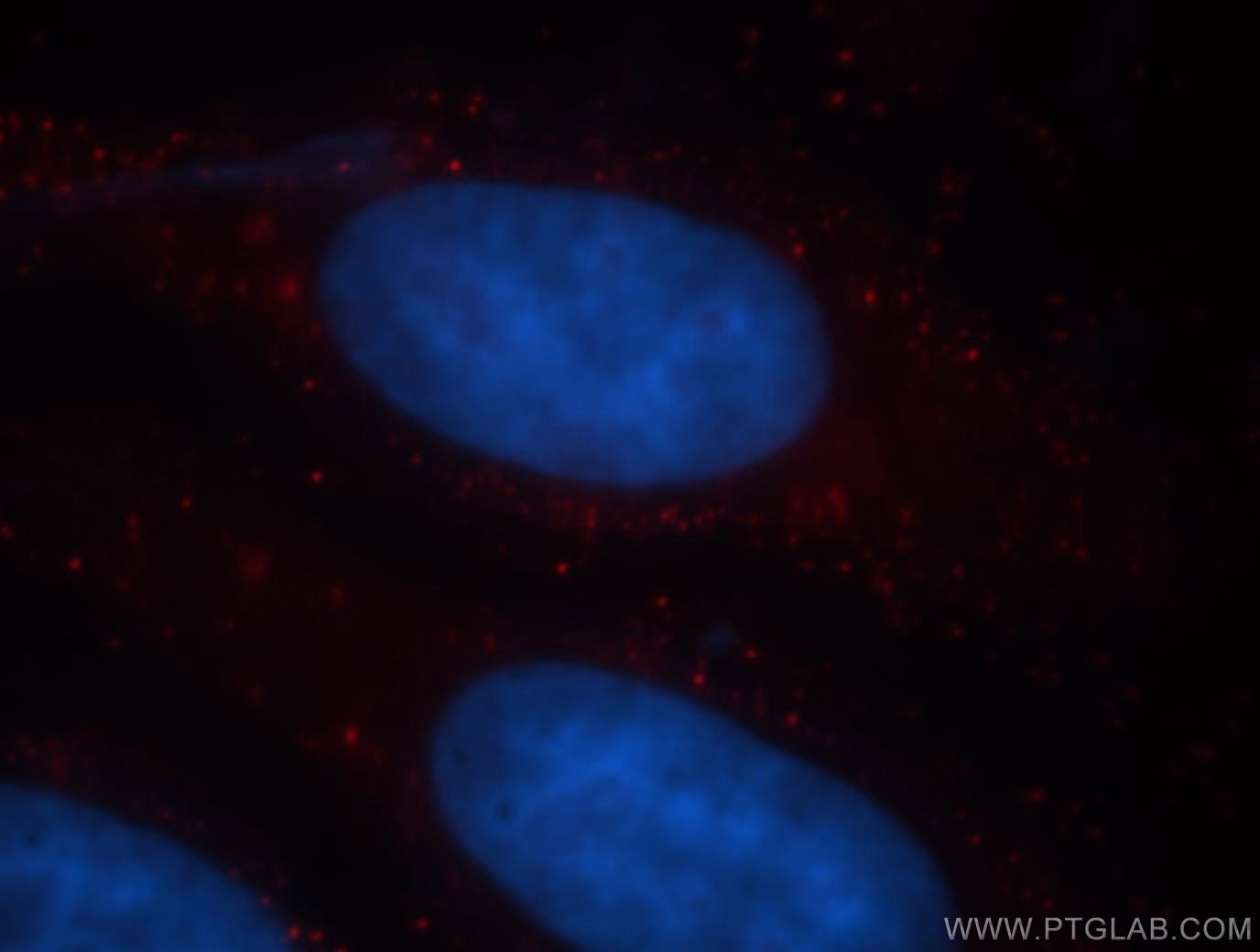 IF Staining of HepG2 using 19207-1-AP (same clone as 19207-1-PBS)