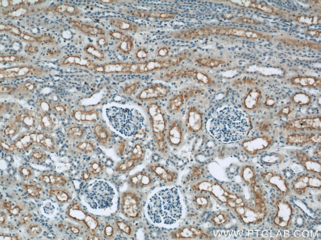 IHC staining of human kidney using 19207-1-AP