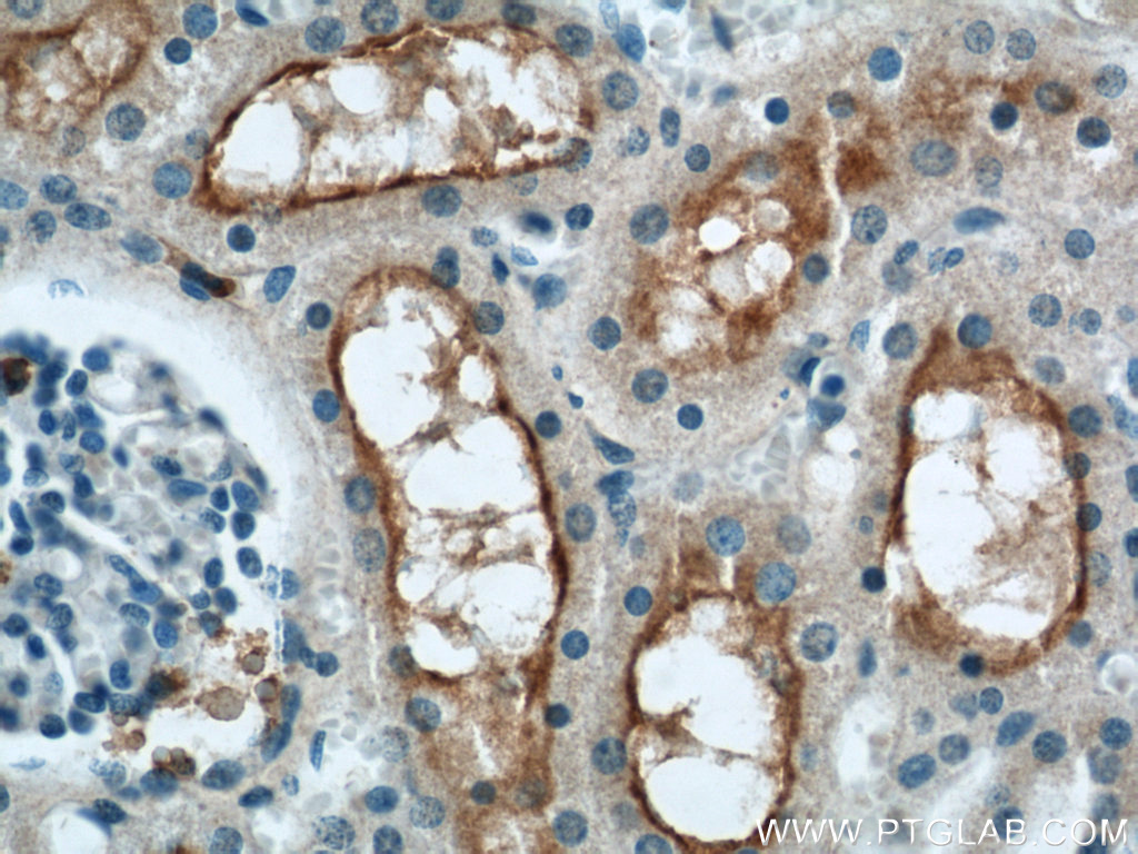 IHC staining of human kidney using 19207-1-AP