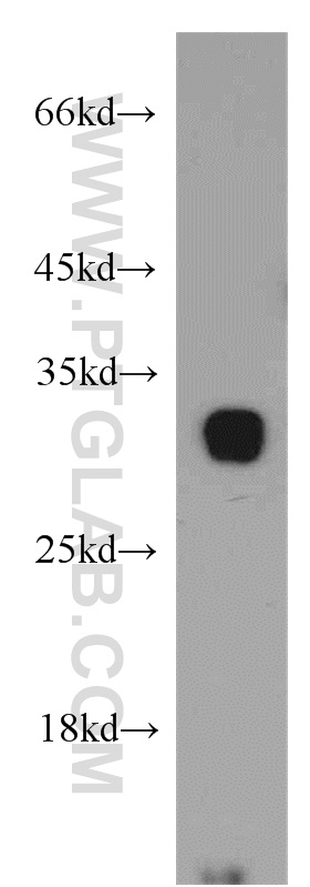 WB analysis of mouse pancreas using 19207-1-AP (same clone as 19207-1-PBS)