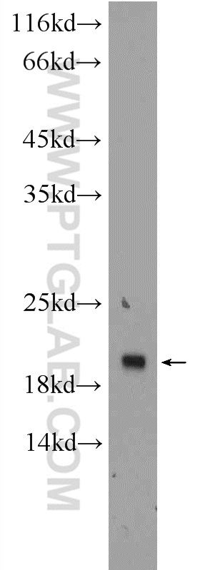 WB analysis of HEK-293 using 24059-1-AP