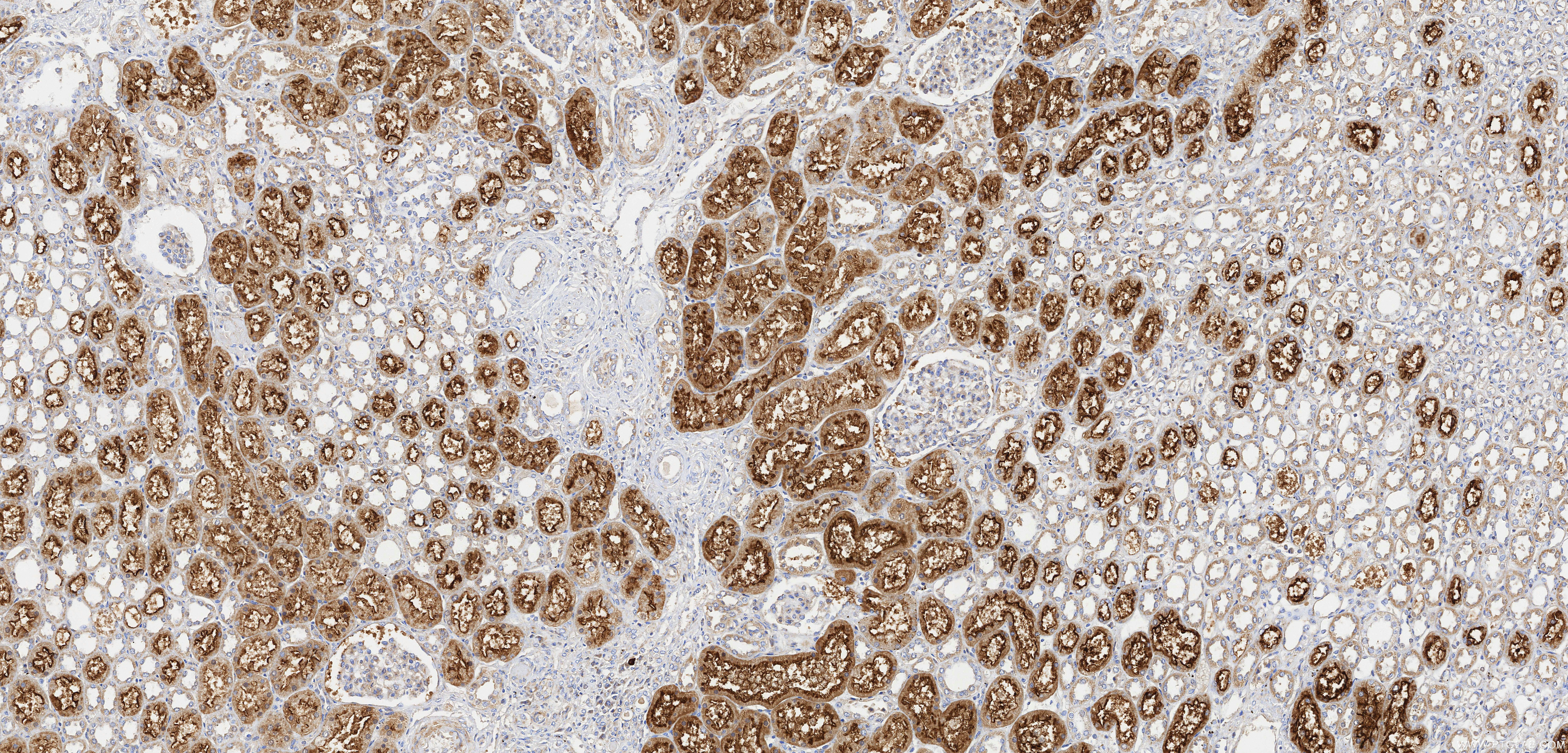 IHC staining of human kidney using 82853-2-RR