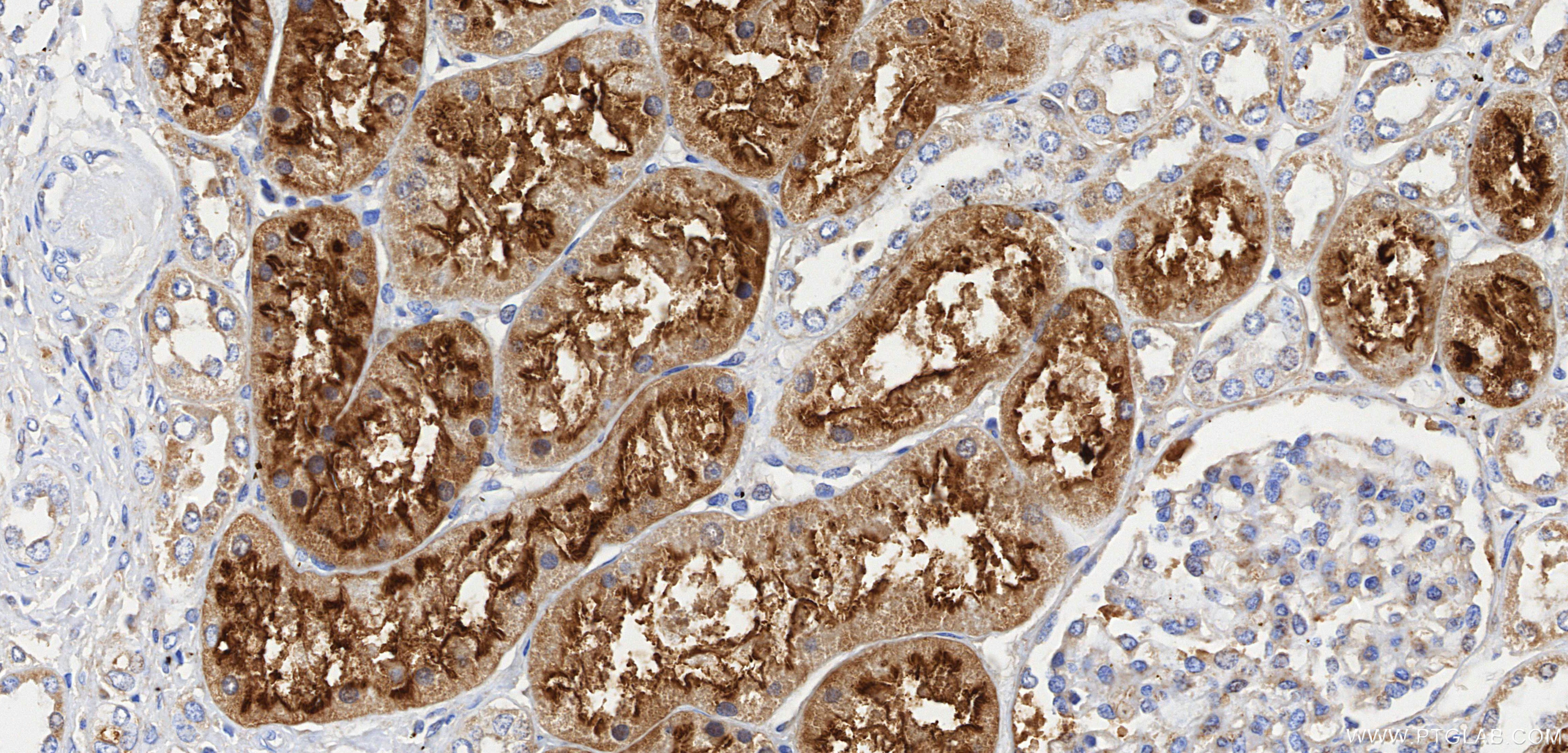 IHC staining of human kidney using 82853-2-RR