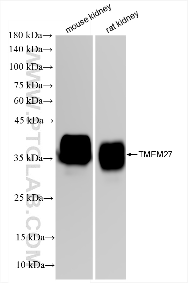 WB analysis using 82853-2-RR (same clone as 82853-2-PBS)