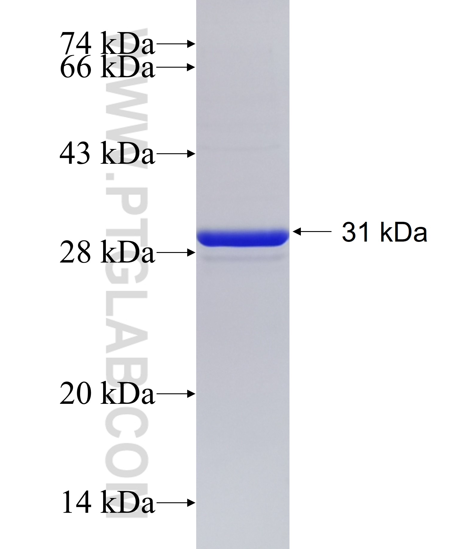 TMEM30B fusion protein Ag20155 SDS-PAGE TMEM30B fusion protein Ag20155 SDS-PAGE