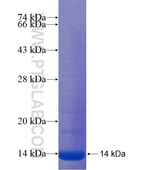 TMEM30B fusion protein Ag20199 SDS-PAGE TMEM30B fusion protein Ag20199 SDS-PAGE