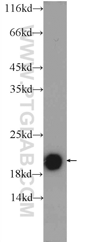 WB analysis of mouse cerebellum using 24786-1-AP