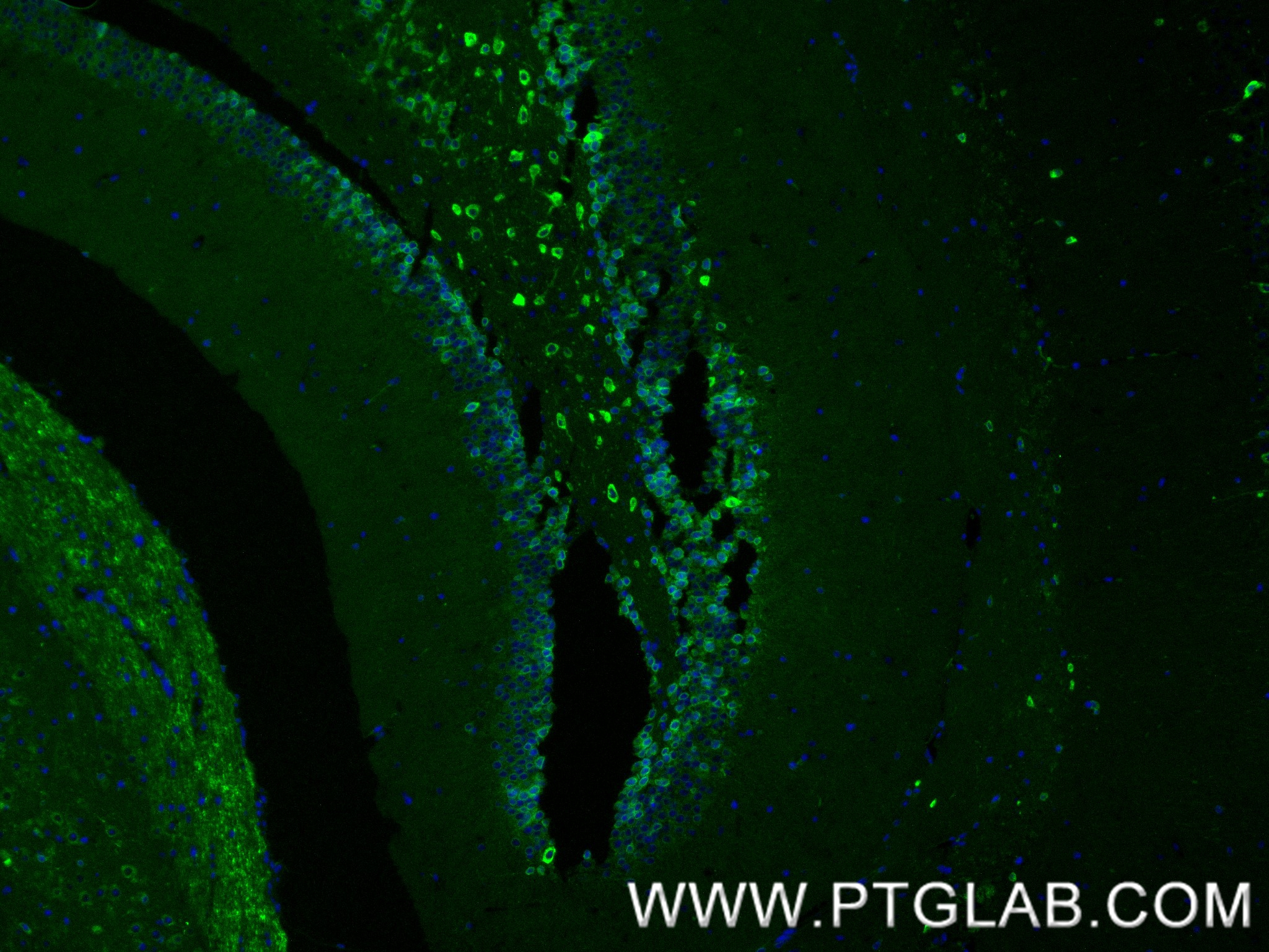 IF Staining of mouse brain using 86724-1-RR (same clone as 86724-1-PBS) IF Staining of mouse brain using 86724-1-RR (same clone as 86724-1-PBS)
