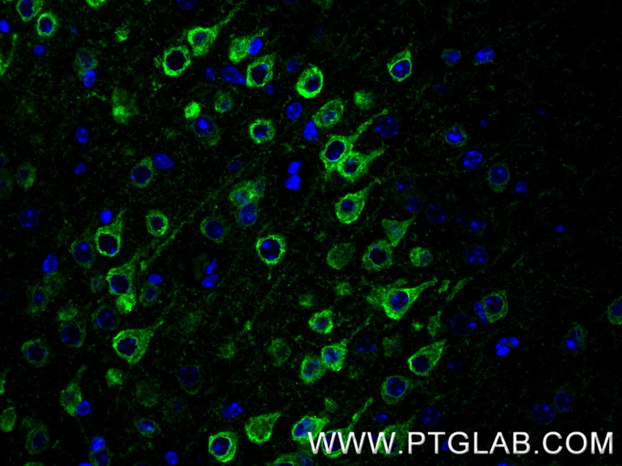 IF Staining of mouse brain using 86724-1-RR (same clone as 86724-1-PBS) IF Staining of mouse brain using 86724-1-RR (same clone as 86724-1-PBS)