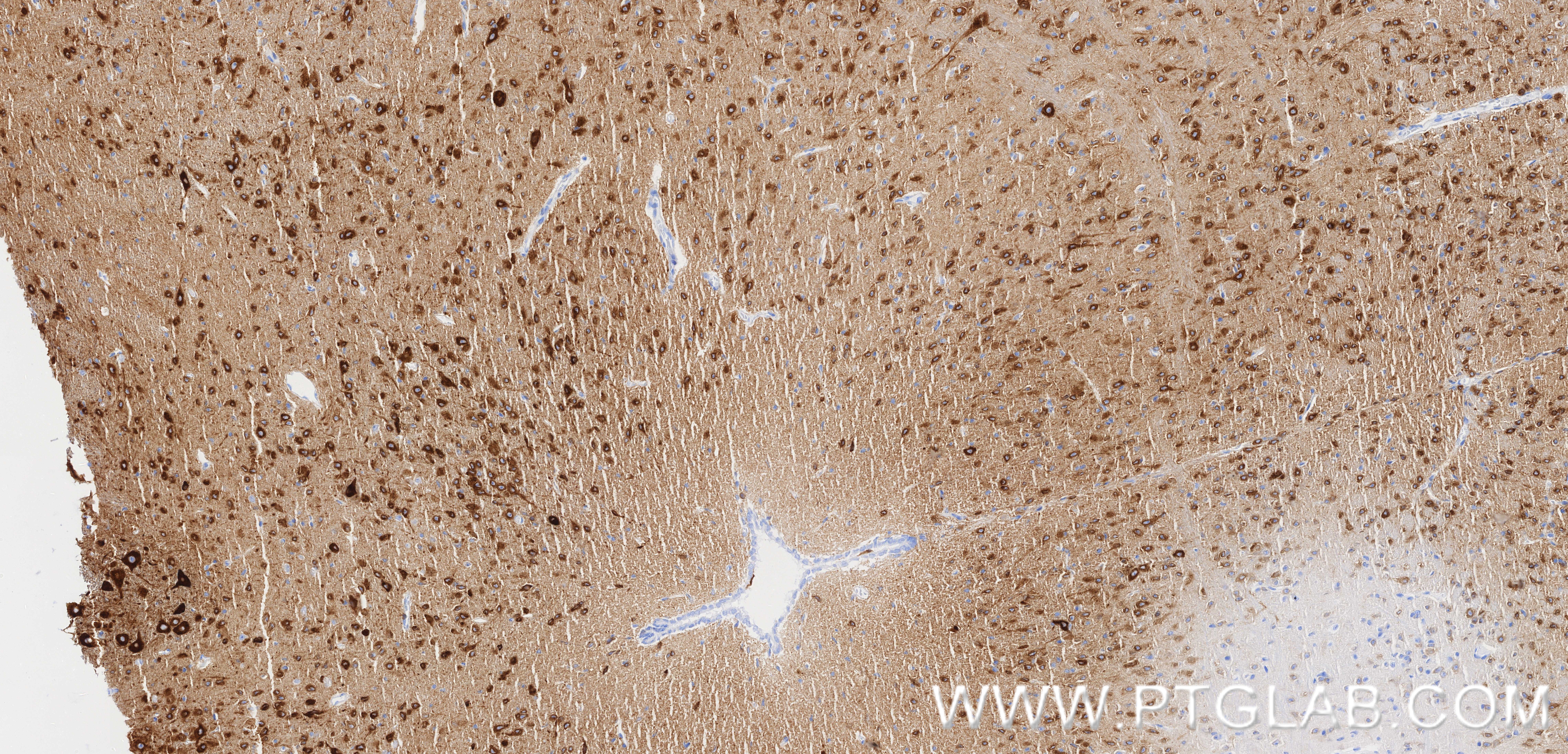 IHC staining of mouse brain using 86724-1-RR