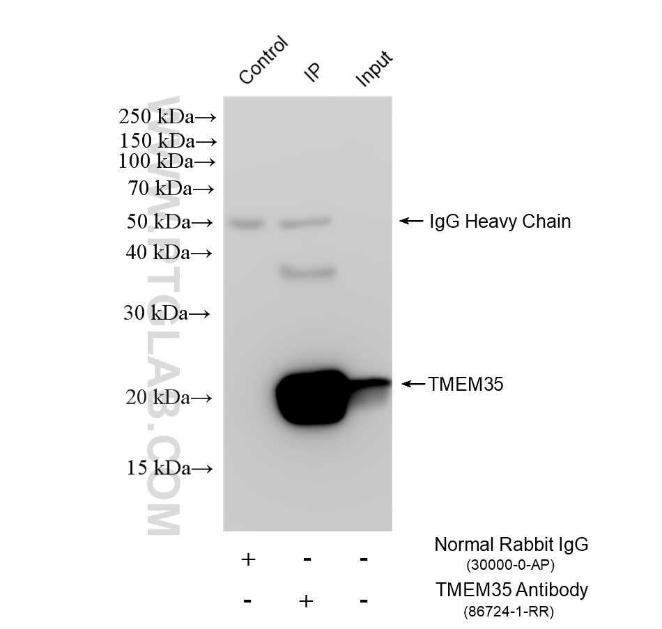 IP experiment of mouse brain using 86724-1-RR