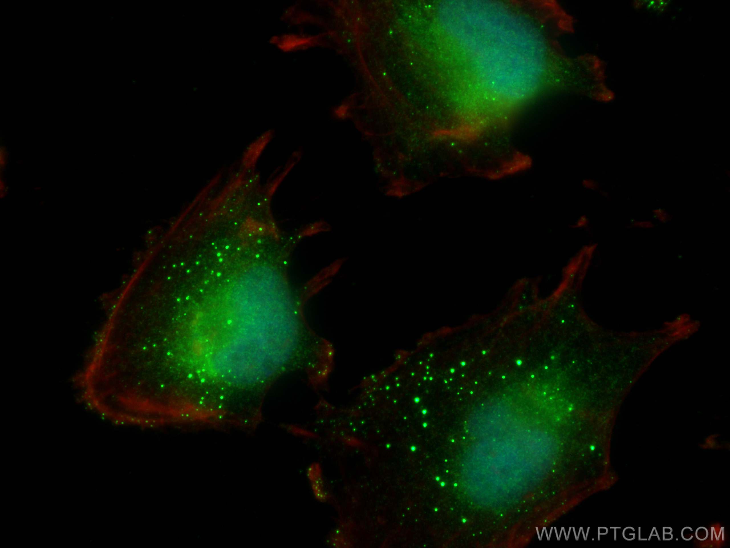 IF Staining of U-251 using 20430-1-AP