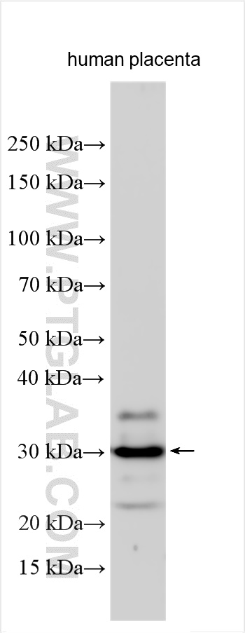 WB analysis using 28066-1-AP