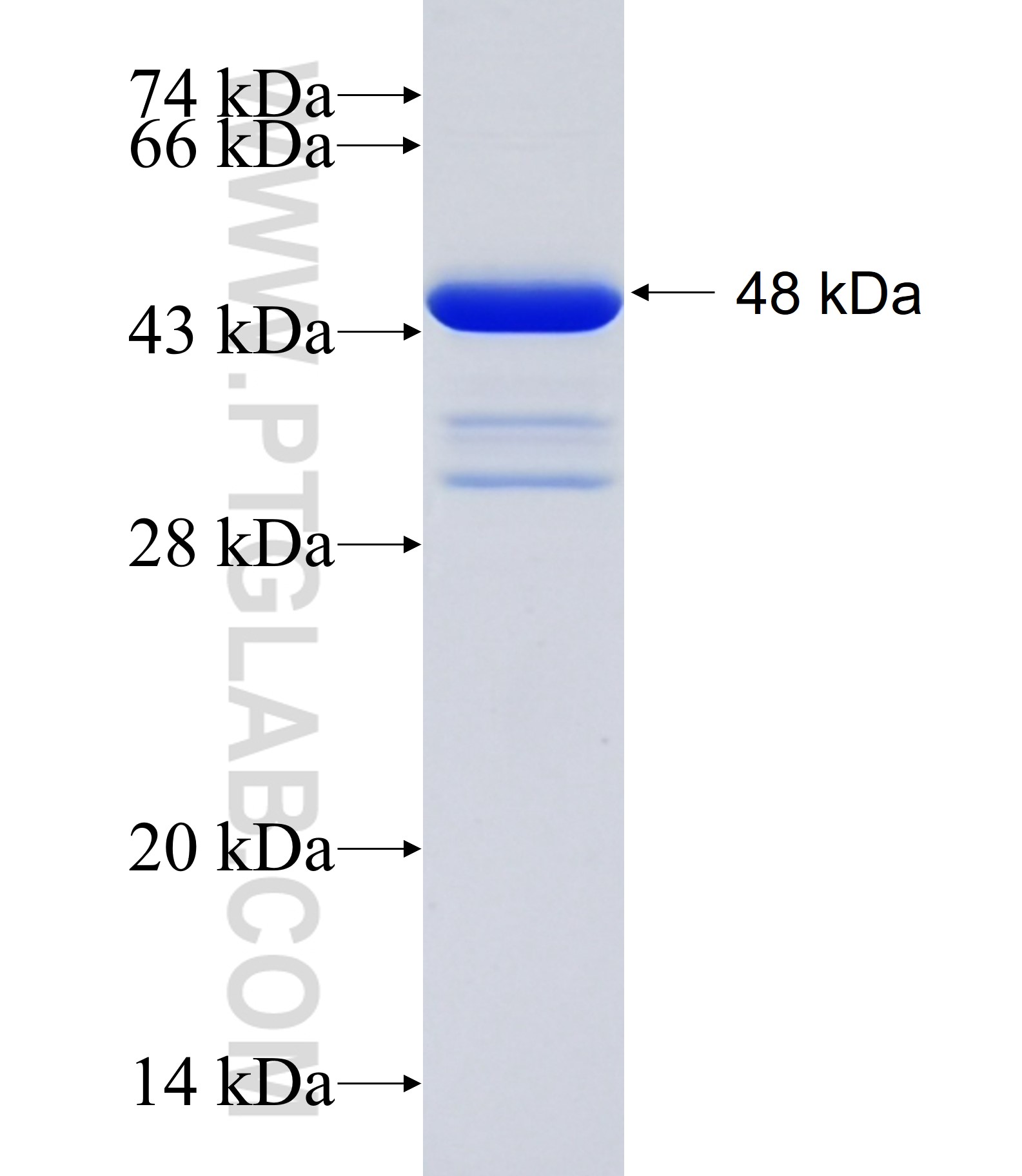 TMEM40 fusion protein Ag27882 SDS-PAGE