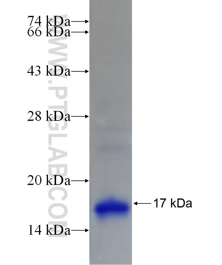 TMEM41A fusion protein Ag15070 SDS-PAGE TMEM41A fusion protein Ag15070 SDS-PAGE