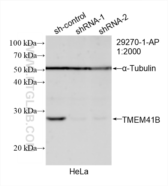 WB analysis of HeLa using 29270-1-AP