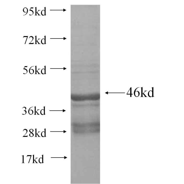 TMEM47 fusion protein Ag10914 SDS-PAGE TMEM47 fusion protein Ag10914 SDS-PAGE