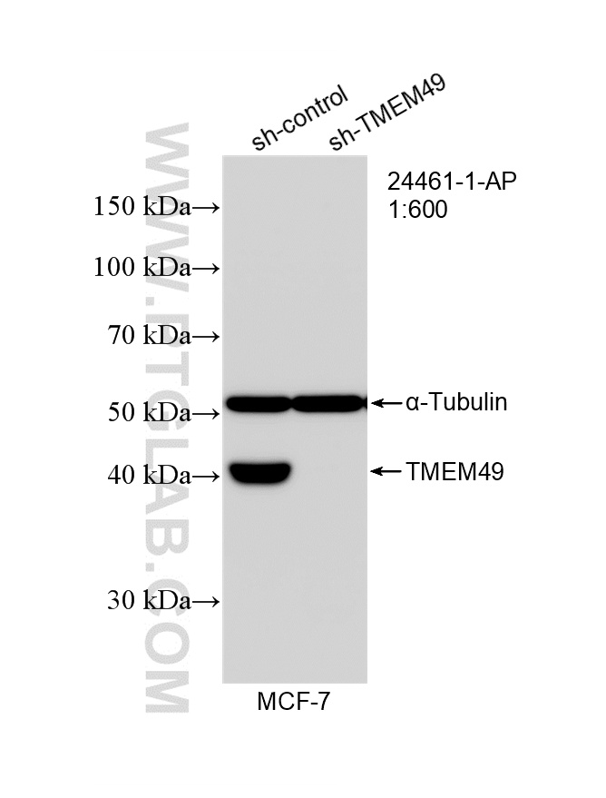 WB analysis of MCF-7 using 24461-1-AP WB analysis of MCF-7 using 24461-1-AP
