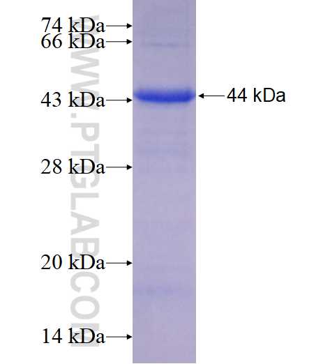 TMEM5 fusion protein Ag10654 SDS-PAGE TMEM5 fusion protein Ag10654 SDS-PAGE