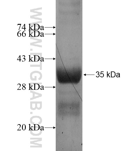 TMEM51 fusion protein Ag13845 SDS-PAGE TMEM51 fusion protein Ag13845 SDS-PAGE