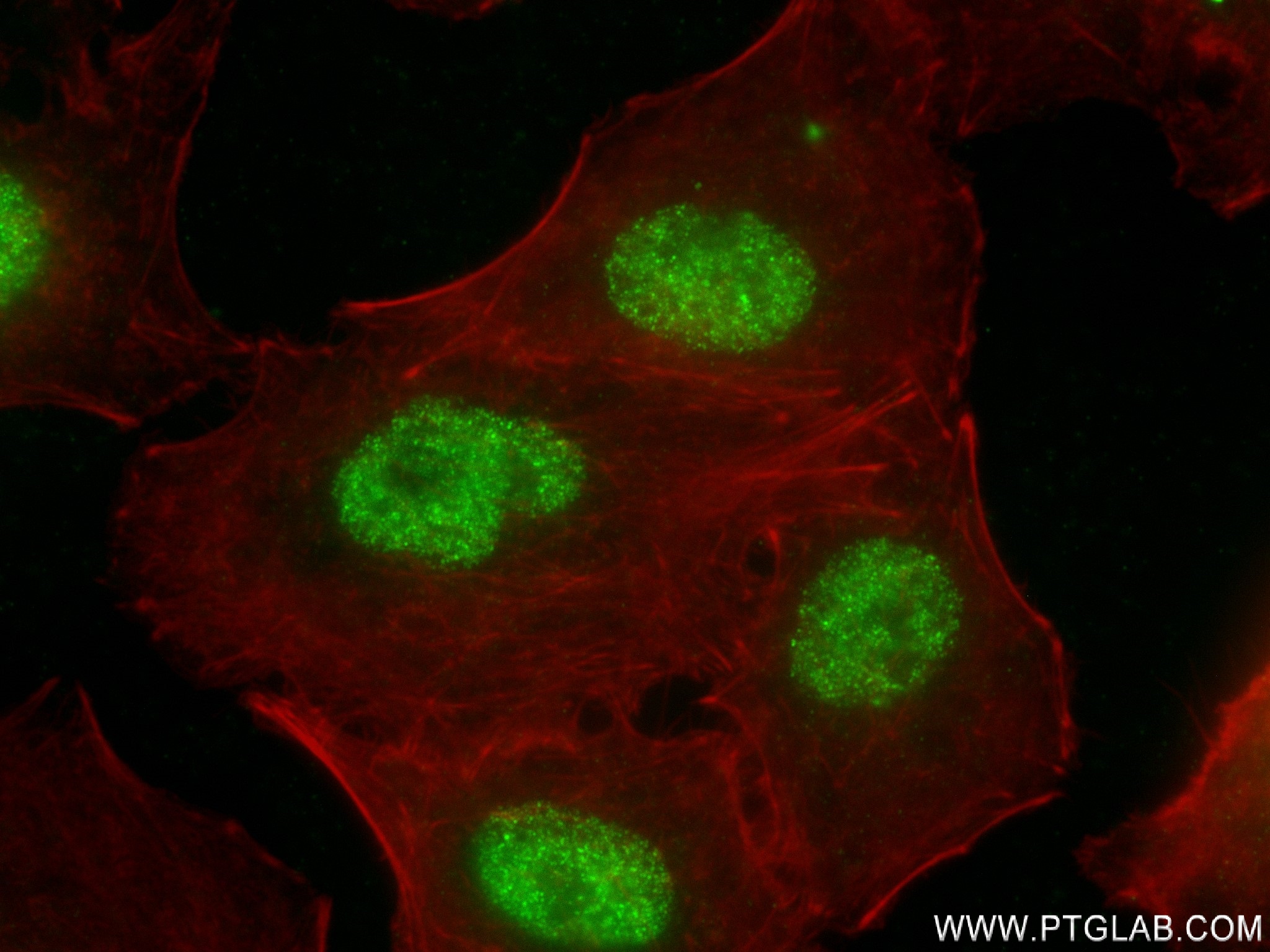 IF Staining of A549 using 83554-3-RR (same clone as 83554-3-PBS)