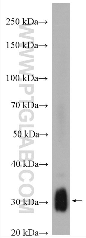 TMEM55B