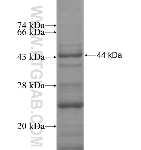 TMEM57 fusion protein Ag15714 SDS-PAGE TMEM57 fusion protein Ag15714 SDS-PAGE