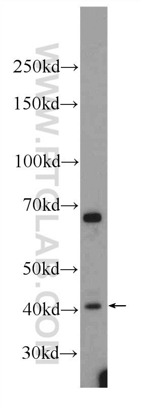 WB analysis of MCF-7 using 24134-1-AP