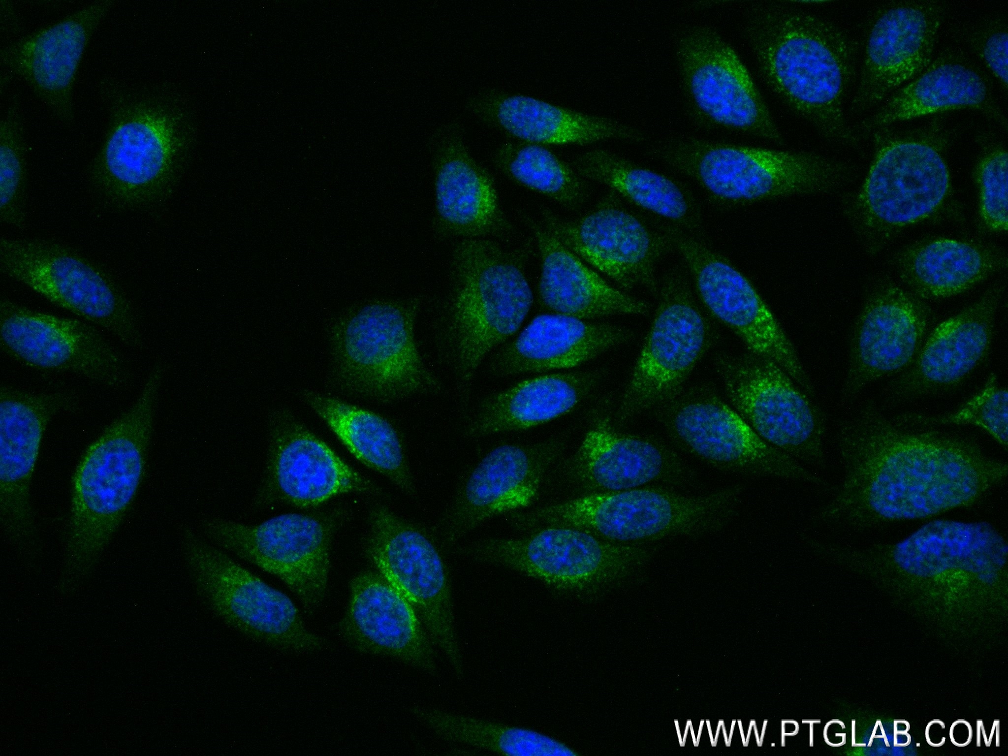 IF Staining of HepG2 using 83656-3-RR (same clone as 83656-3-PBS)