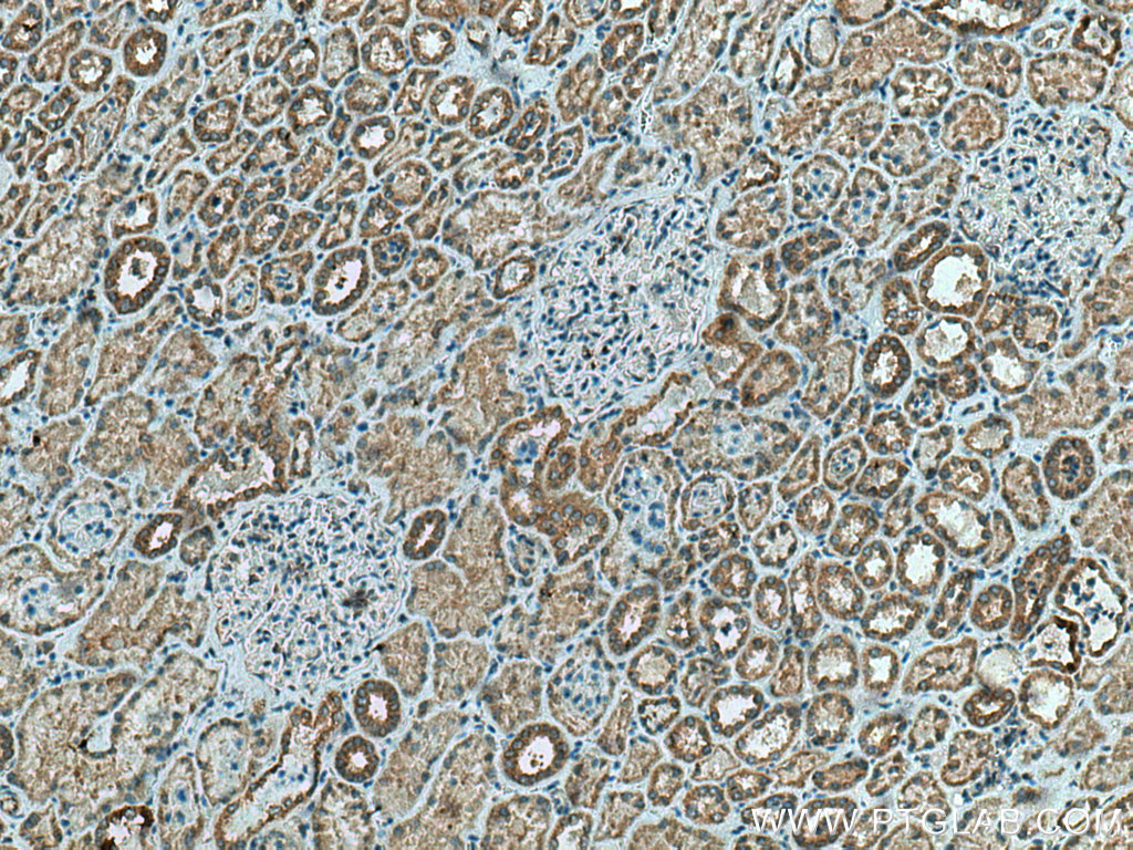 IHC staining of human kidney using 20997-1-AP