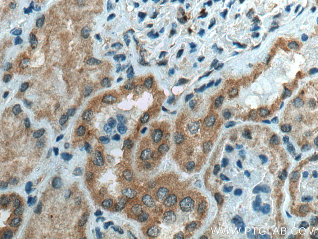 IHC staining of human kidney using 20997-1-AP