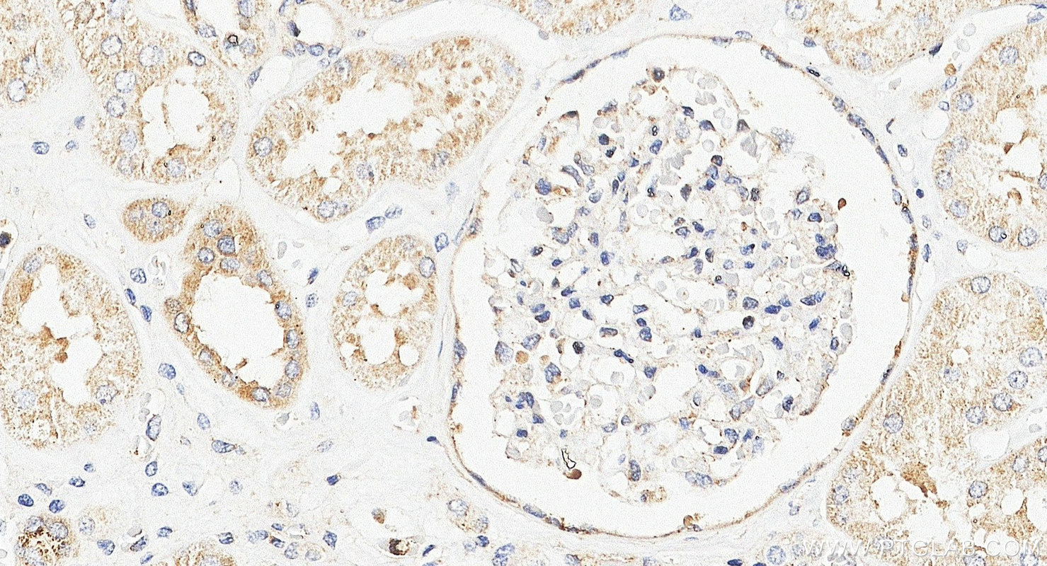 IHC staining of human kidney using 20997-1-AP IHC staining of human kidney using 20997-1-AP