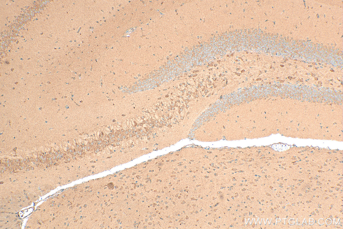 IHC staining of mouse brain using 21274-1-AP