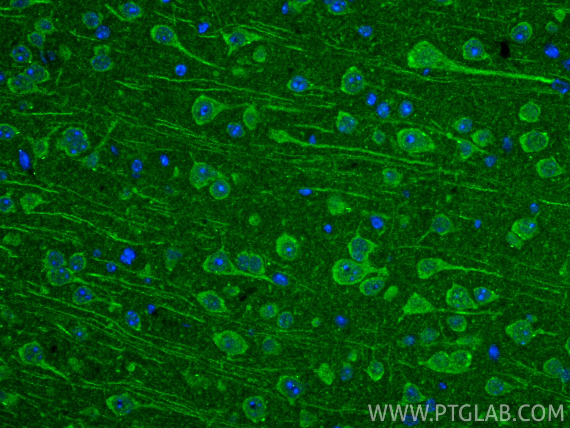 IF Staining of mouse brain using 20388-1-AP