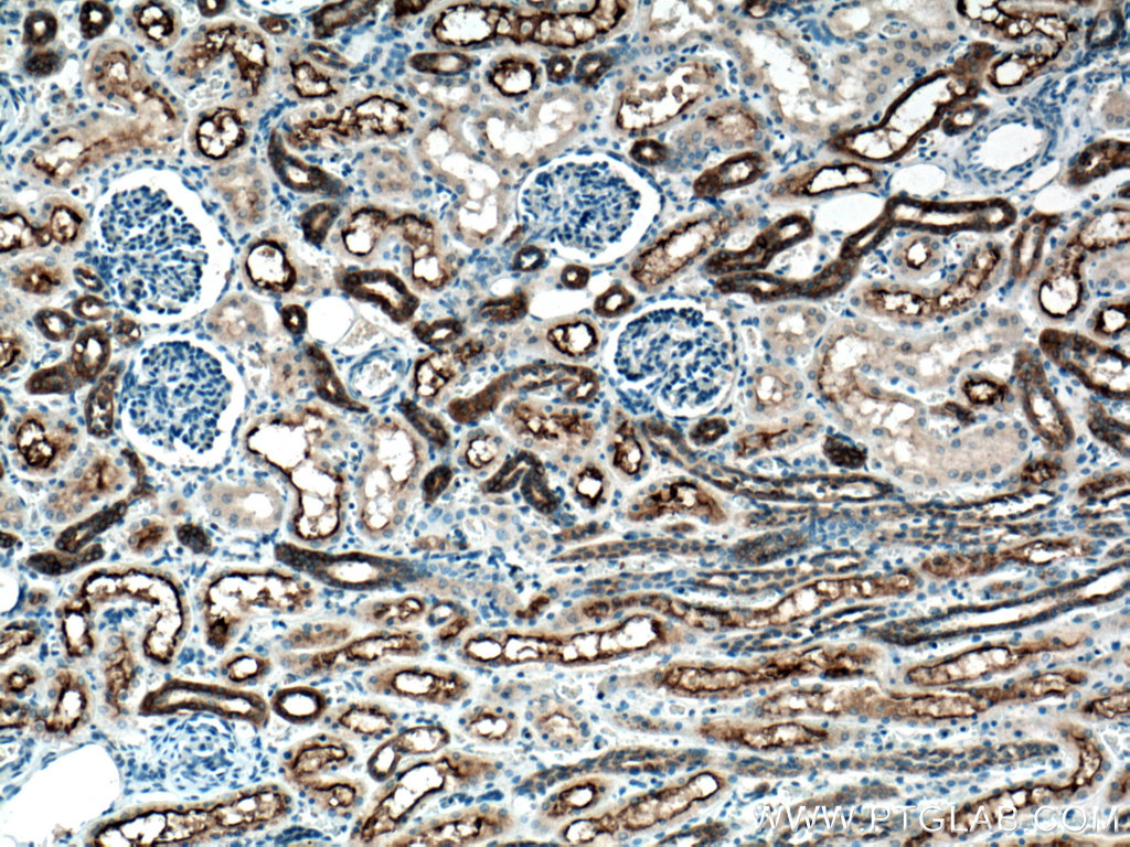 IHC staining of human kidney using 28049-1-AP