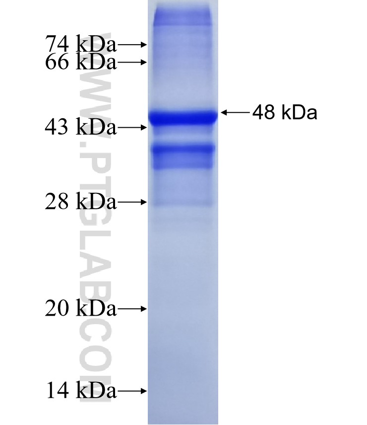TMEM72 fusion protein Ag21553 SDS-PAGE