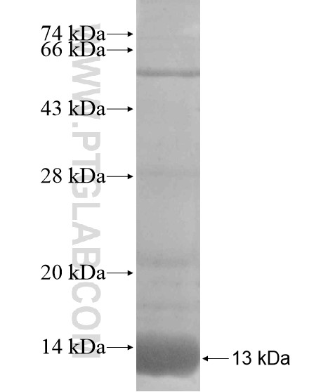 TMEM75 fusion protein Ag18916 SDS-PAGE TMEM75 fusion protein Ag18916 SDS-PAGE